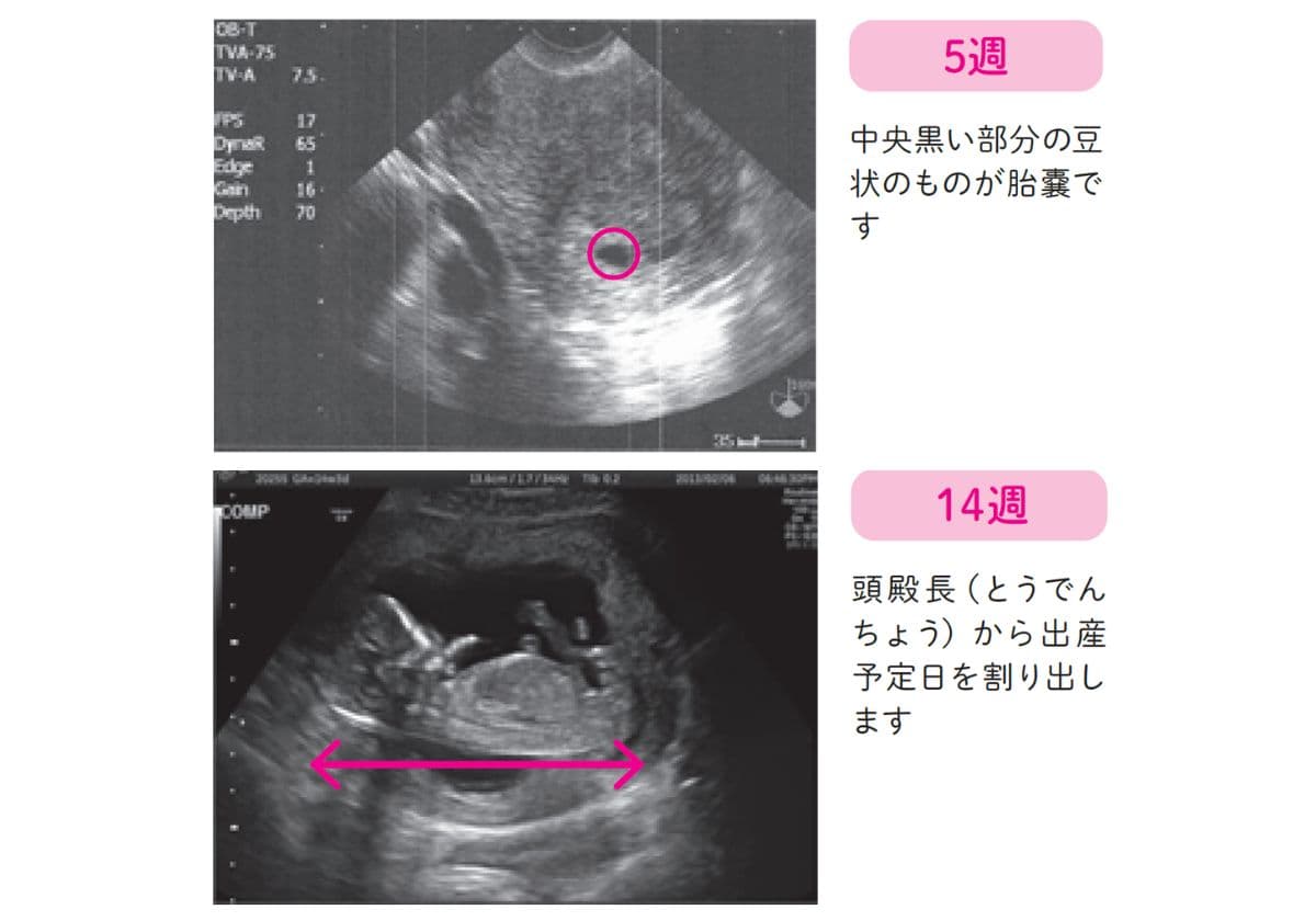 はじめてでもよくわかる 知っておきたい妊娠と出産安心BOOK